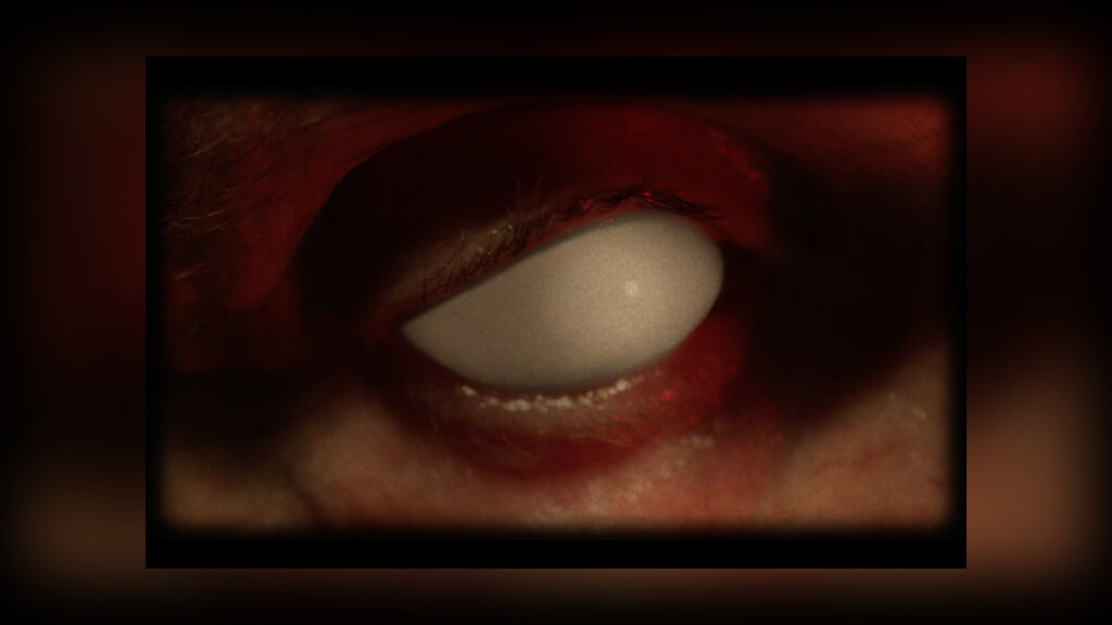 MR. BUNGLE Eracist Video - Cover Photo