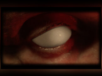 MR. BUNGLE Eracist Video - Cover Photo