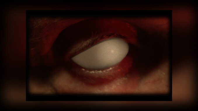 MR. BUNGLE Eracist Video - Cover Photo