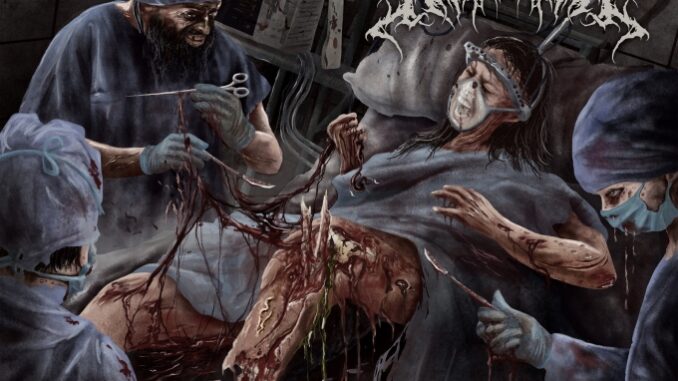 EPK – Impending Annihilation – Idiopathic Osteonecrosis of the Femoral Head (2024) (Gore House Productions) EPK – Impending Annihilation – Idiopathic Osteonecrosis of the Femoral Head (2024) (Gore House Productions)