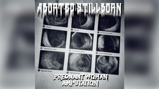 ABORTED STILLBORN 'Pregnant Woman Amputation' - Cover Photo